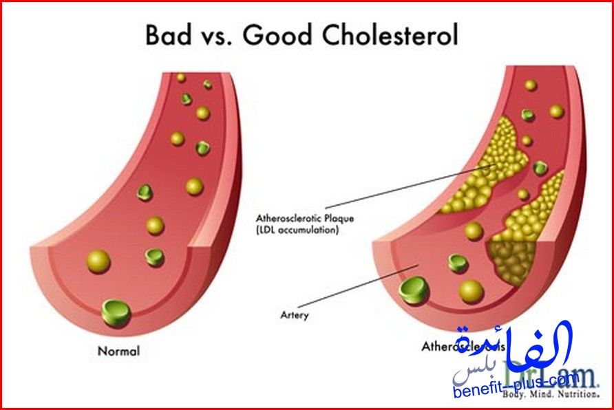اضرار ارتفاع الكوليسترول أطعمة تخفض الكوليسترول