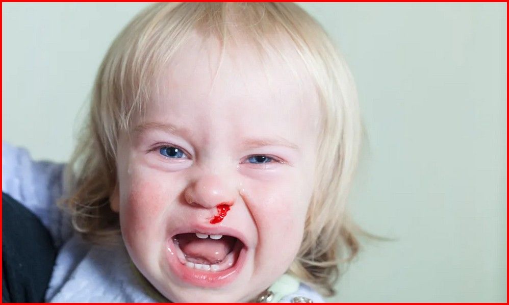  (تكسر الدم) (علاج الانيميا عند الاطفال) سيولة الدم التهاب في الدم التهاب الدم عند الاطفال اسباب الرعاف المتكرر